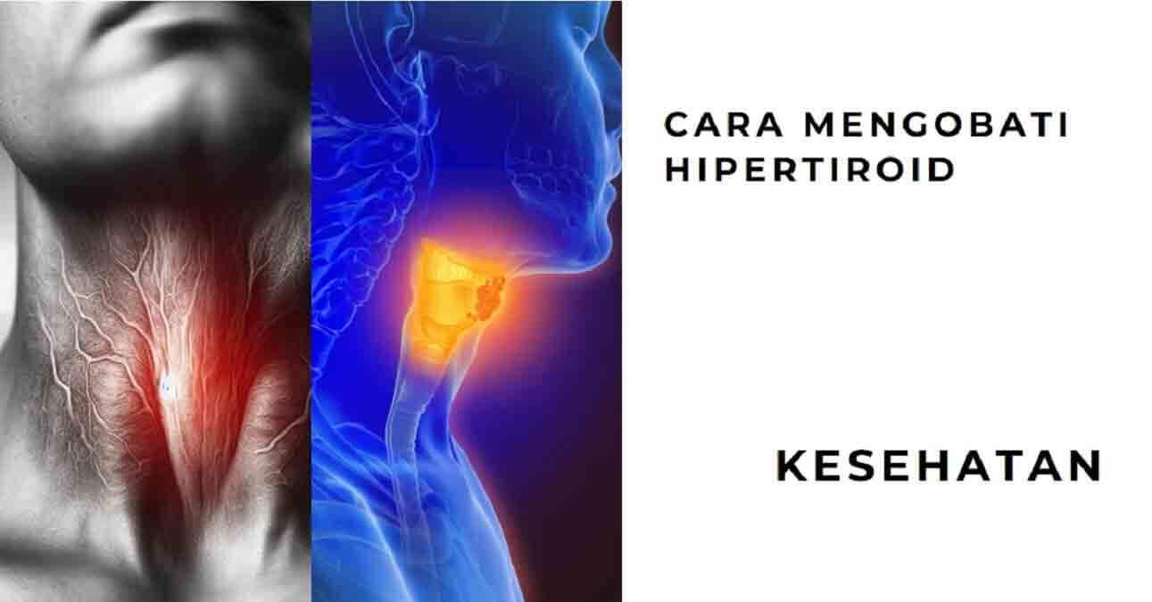 Cara Mengobati Hipertiroid dengan Mudah dan Aman