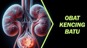 Obat Kencing Batu