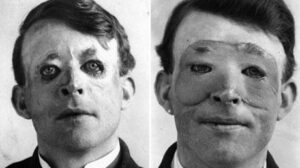 Cantik atau tampan dengan operasi plastik