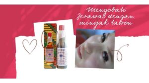 Cara mengobati Jerawat dengan Minyak Tawon