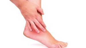 Cara mengobati keseleo dengan minyak tawon