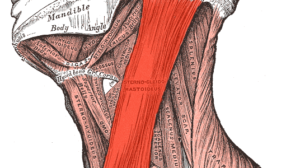Cara mengobati otot leher kaku