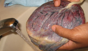 Melahirkan Dengan Cara Lotus Birth