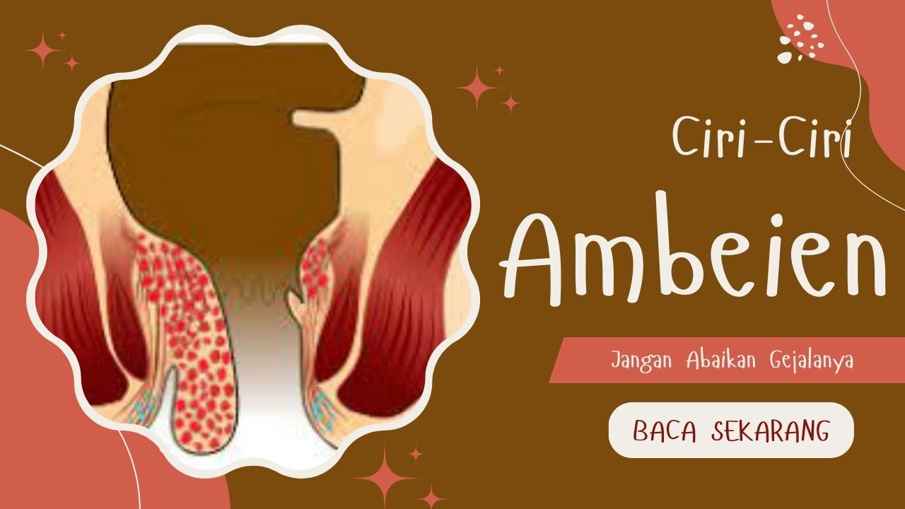 Mengenal 10 Ciri Ciri Ambeien: Jangan Abaikan Gejala yang Muncul!
