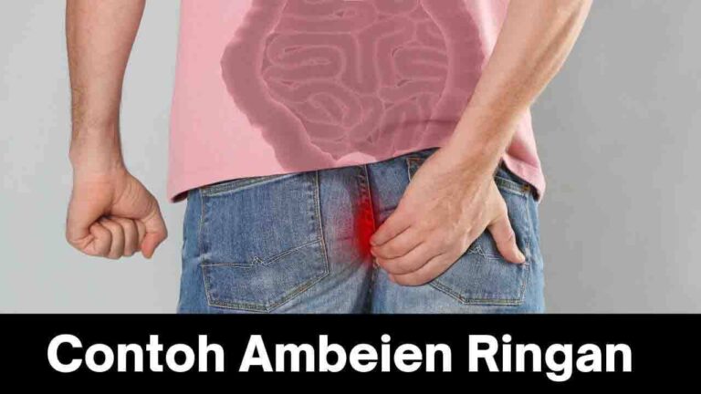 Contoh Ambeien Ringan: Kenali Gejala dan Pengobatan yang Tepat