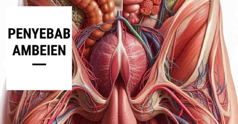 Waspada! 10 Penyebab Ambeien yang Sering Diabaikan Orang [Wasir]